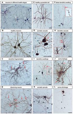Genetically Encoded Calcium Indicators Can Impair Dendrite Growth of Cortical Neurons